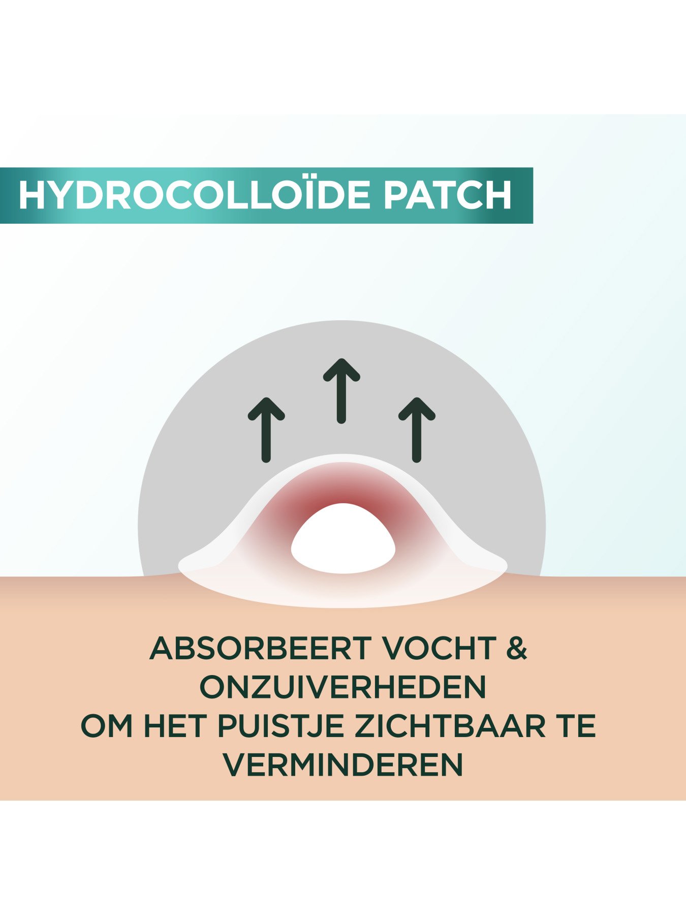 3600542619103 5 NL
