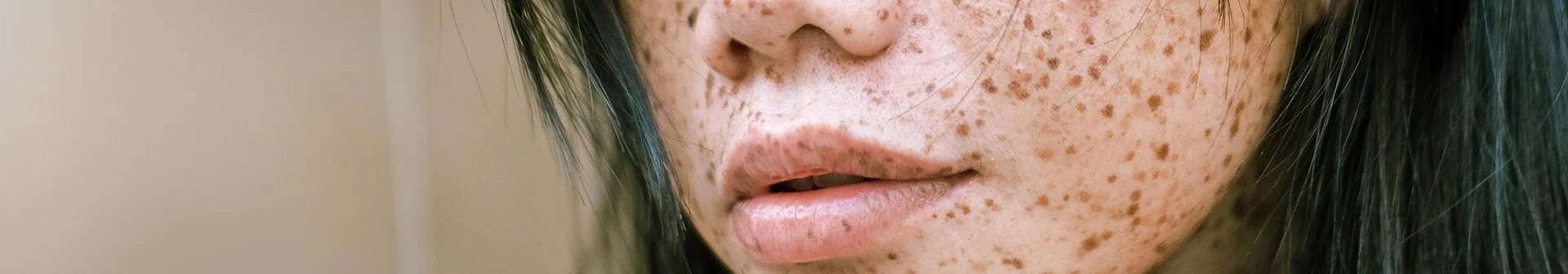 231120 garnier redaktionelle artikel pigmentstoerung header 1920x336px