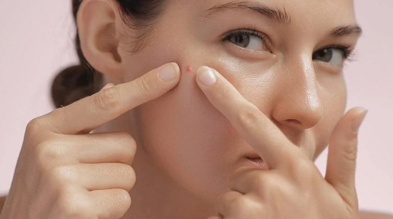 pimple-patches-werkt-dat-3