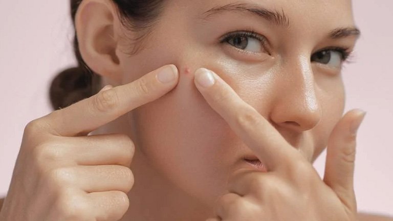 pimple patches werkt dat 4